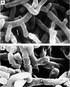 Scanning electron microscopy of R. ruber cells of the intermediate zone of a one-day colony grown on nutrient agar