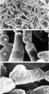 Scanning electron microscopy. R. ruber IEGM 87 cells grown on mineral salts agar in the presence of propane