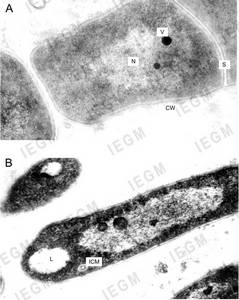 Ultra thin sections of R. ruber cells grown on nutrient agar