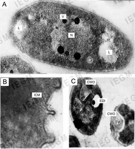 Ultra thin sections of R. ruber cells grown on MSM with propane