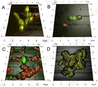 Combined 3D AFM-CLSM images of R. ruber IEGM 346 grown in MSM for 10 days in the presence of glucose and an ecotoxicant