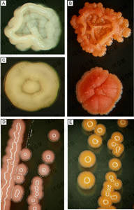 Colonies of different Rhodococcus species on nutrient agar