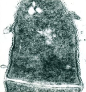 Image of microvesicles of R. ruber IEGM 333